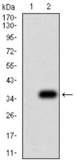 Parvovirus NS1 Antibody (8E6E10) - BSA Free, Novus Biologicals 0.1 ml;